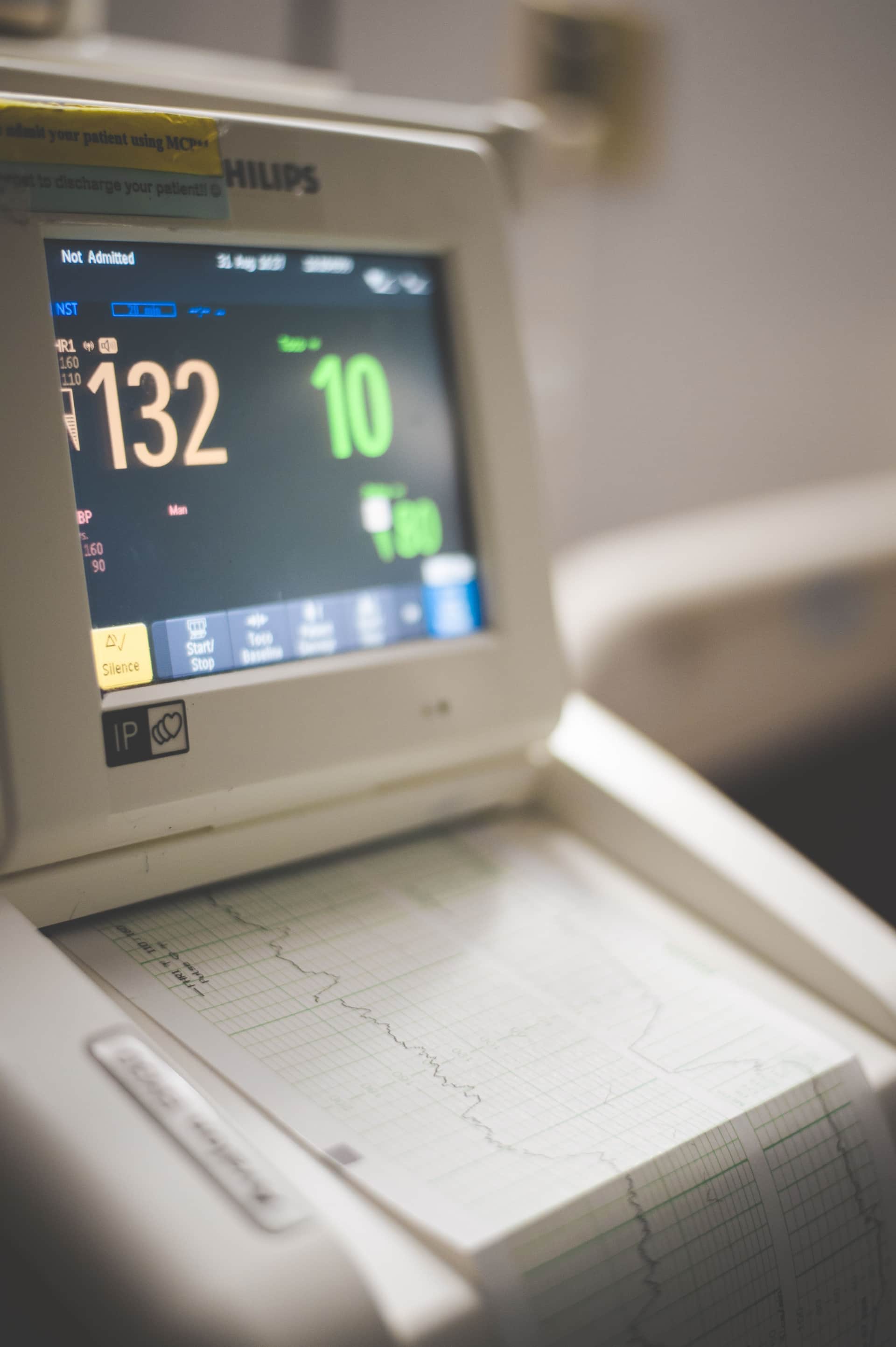 ECG